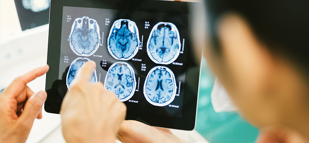 Doctors studying a brain scan