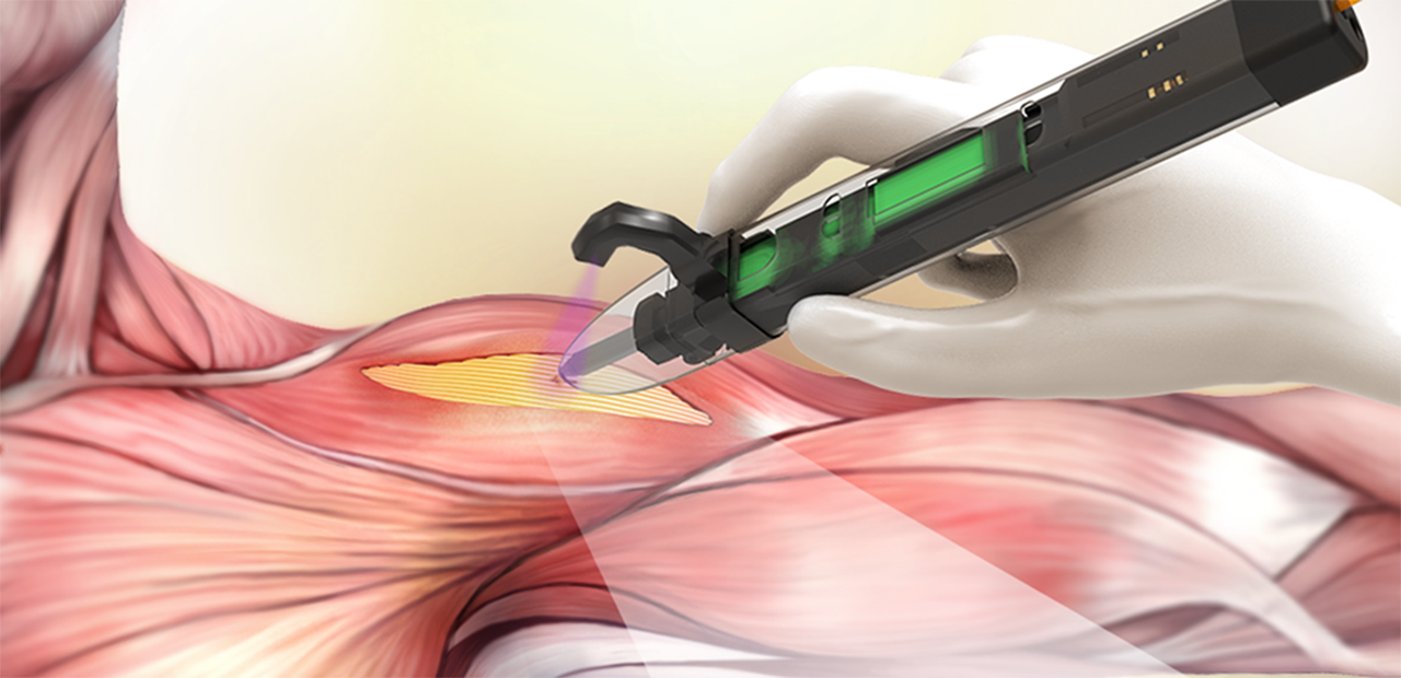 Handheld 3D bioprinter