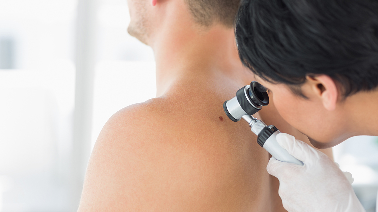 A doctor examining a mole on the back of a man