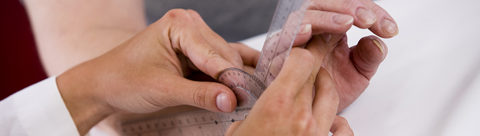 Doctor measuring a patient's hand