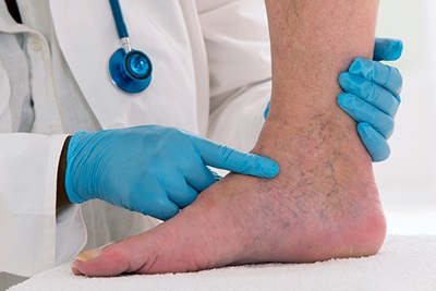Lower limb vascular examination