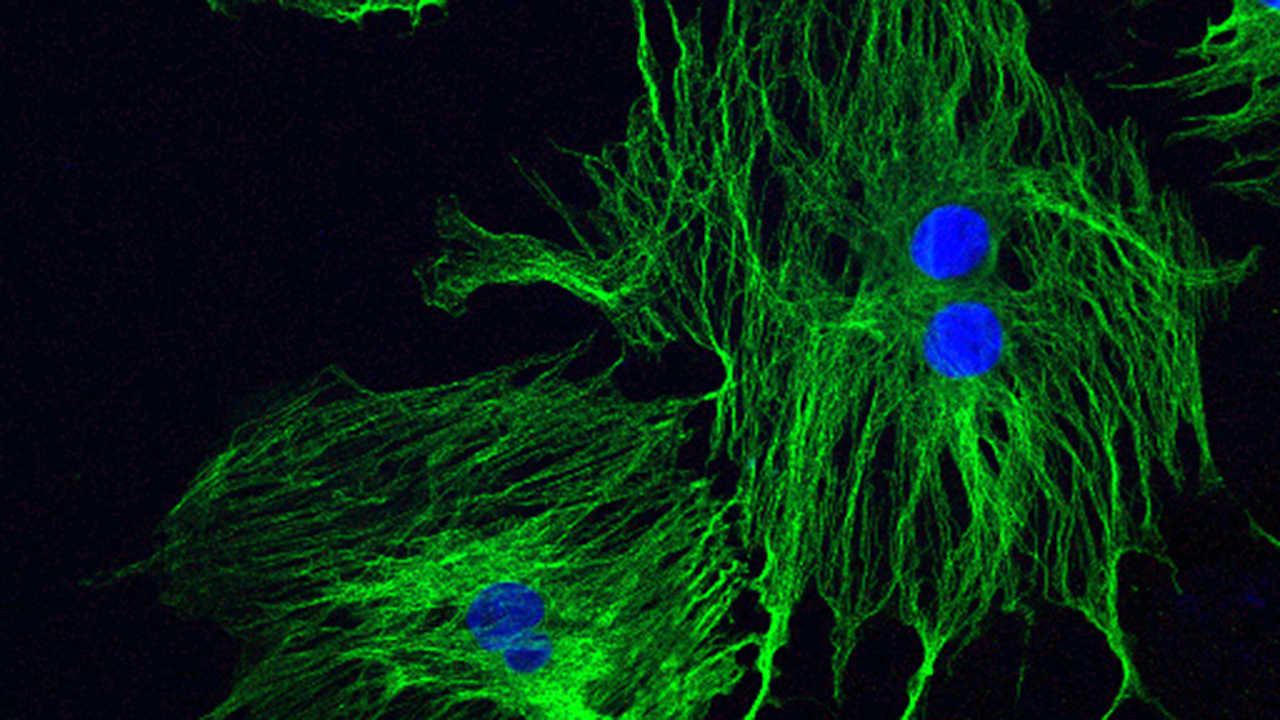 Confocal image of microtubule assembly in dividing mesenchymal stem cells labeled with anti-tubulin antibody (green). To-Pro stained nuclei are shown in blue.