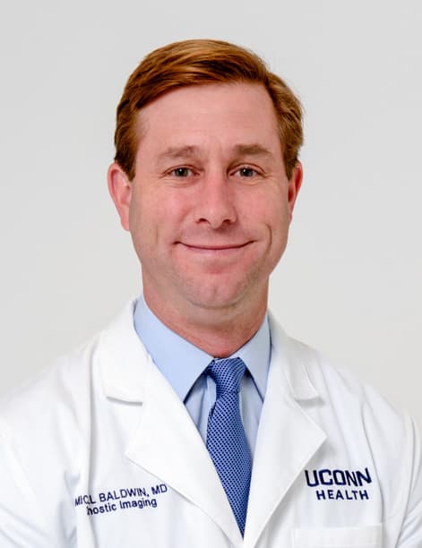 Michael Baldwin, MD